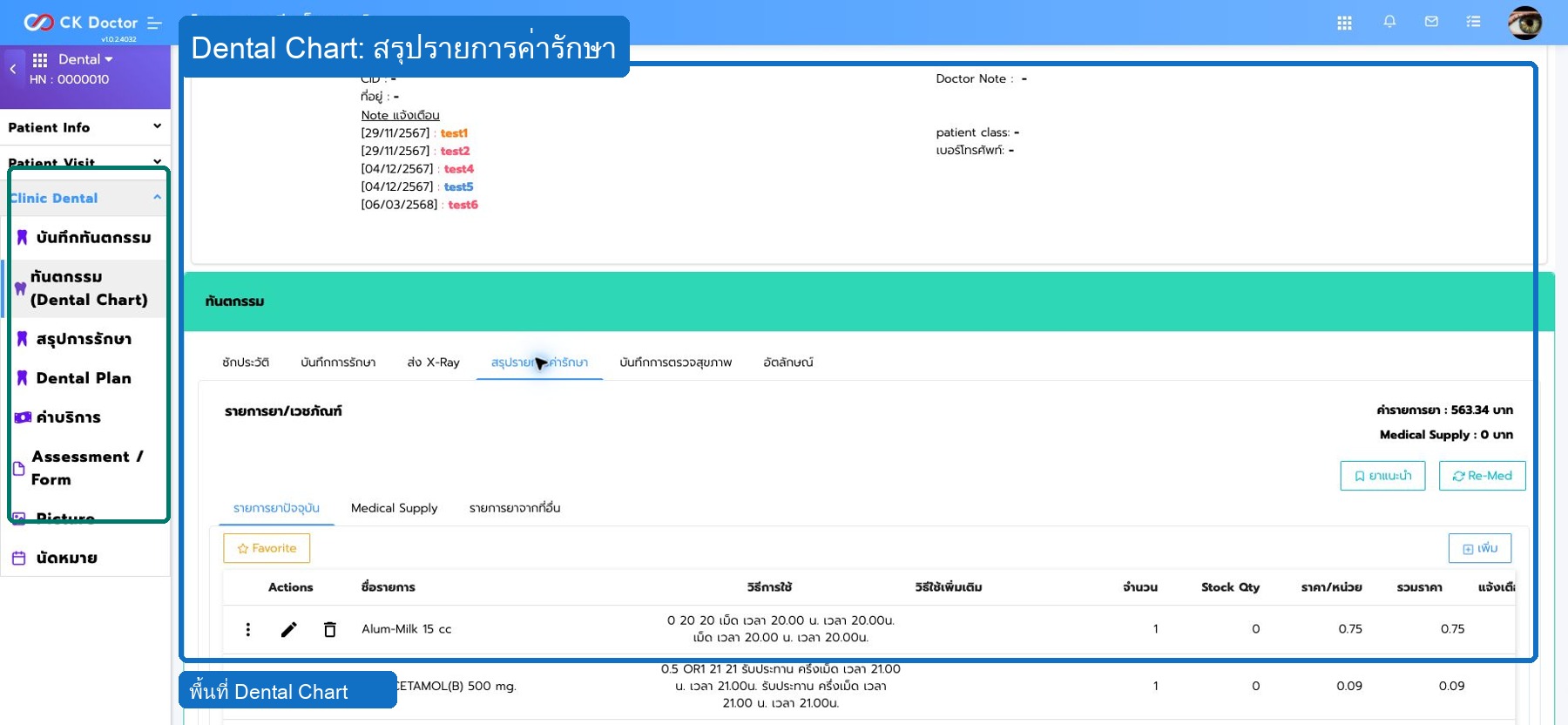 Dental Chart  สรุปรายการค่ารักษา