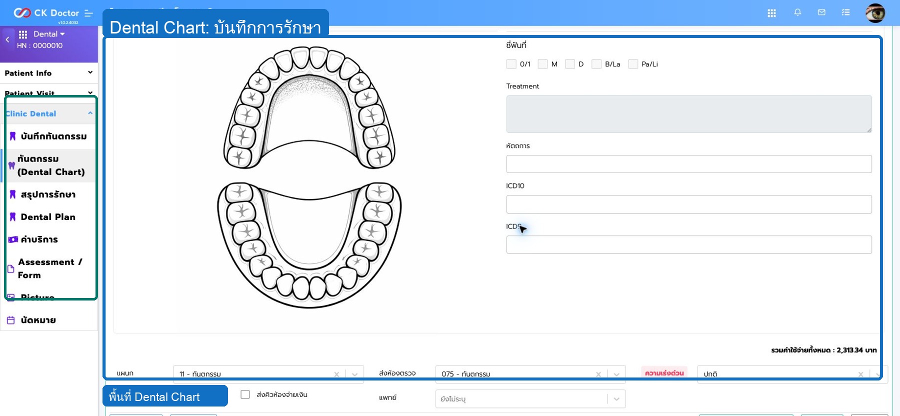 Dental  Dental Chart ภาพรวมแฟ้มทันตกรรม