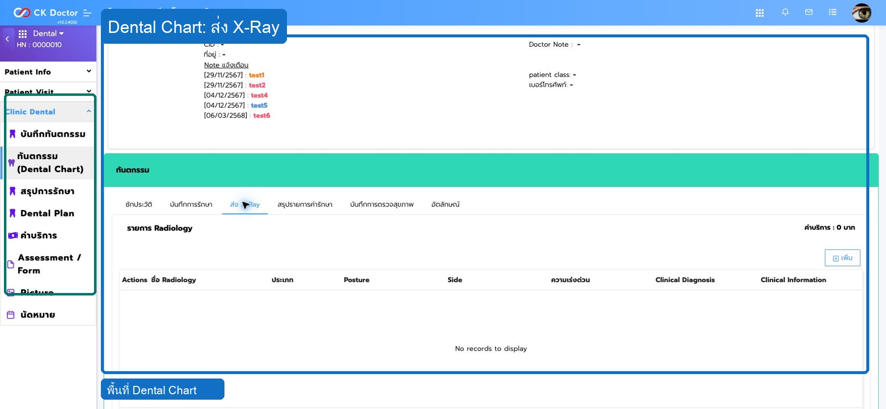 Dental  ส่ง X-Ray ค่ารักษา ใบสั่งยา และปิดงานตรวจ