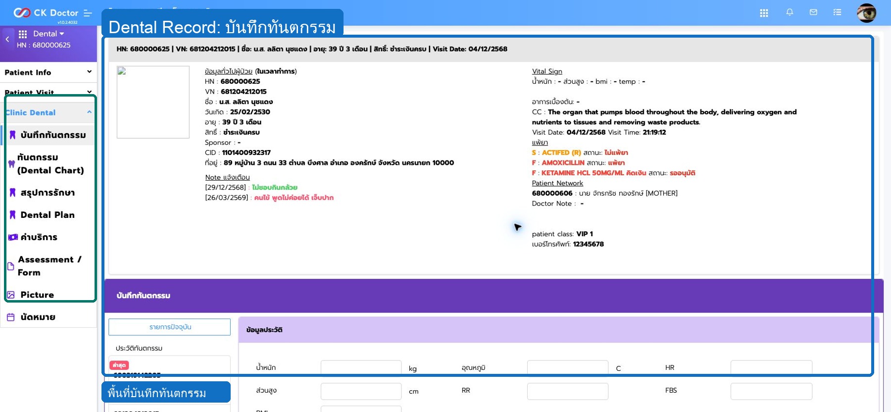 Dental  แพ้ยา ความเสี่ยง และประวัติก่อนรักษา