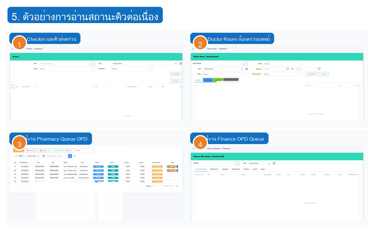 รูปที่ 5 จุดอ่านสถานะสำคัญในงาน OPD