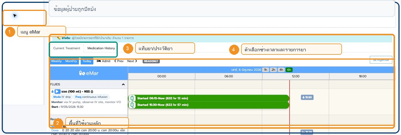 หน้าจอ eMar ใน Patient Chart พร้อมตำแหน่งสำคัญ