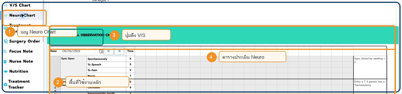 หน้าจอ Neuro Chart ใน Patient Chart พร้อมตำแหน่งสำคัญ