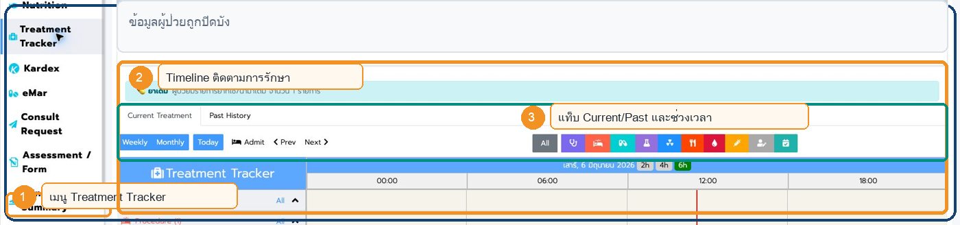 หน้าจอ Treatment Tracker ใน Patient Chart พร้อมตำแหน่งสำคัญ